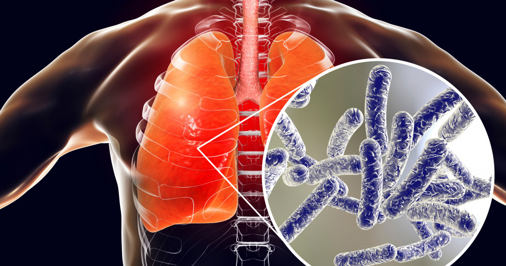 La santé publique de la Montéégie enquête sur sept cas de légionellose à Sainte-Julie