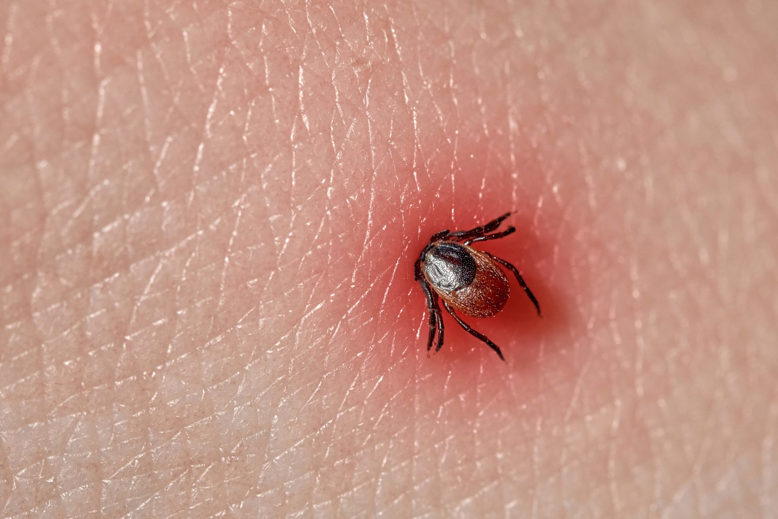 RandoLyme : une marche pour sensibiliser à la maladie de Lyme