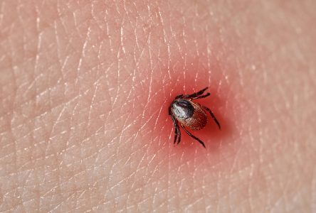 RandoLyme : une marche pour sensibiliser à la maladie de Lyme